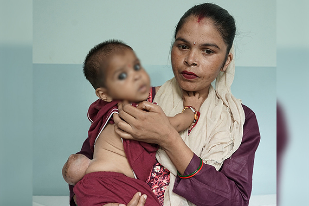 A Little Fighter: Help Baby Harshi Get Her Surgery