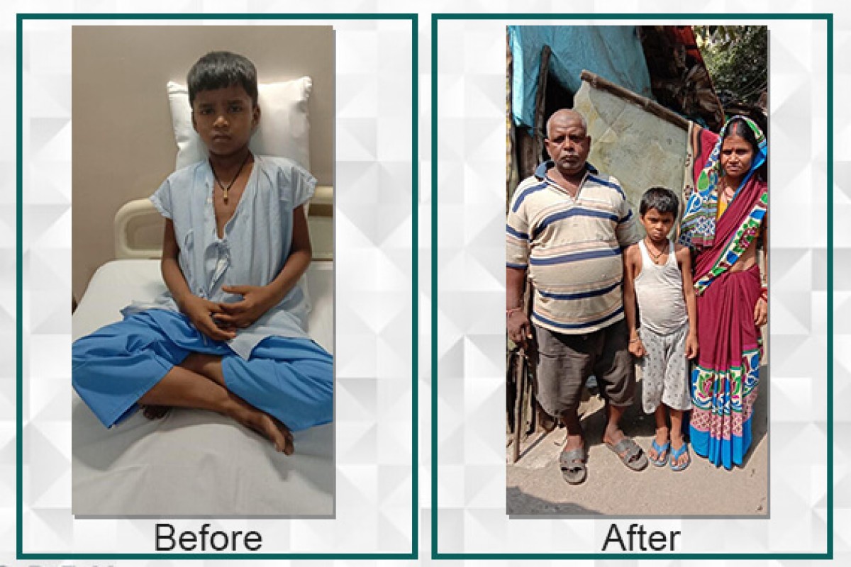 Kundan diagnosed with a heart defect was able to undergo immediate surgery with the raised fund