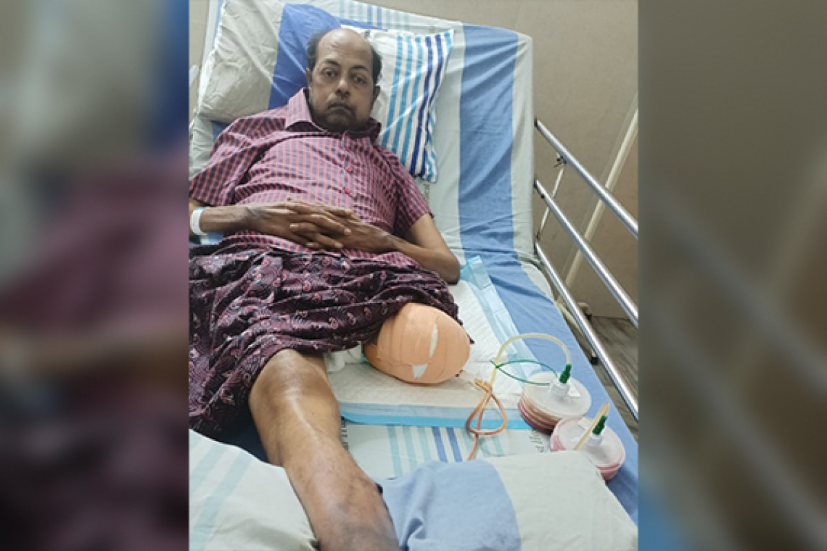 A Limb of Hope: Support Mr. Joseph’s Fight for Independence