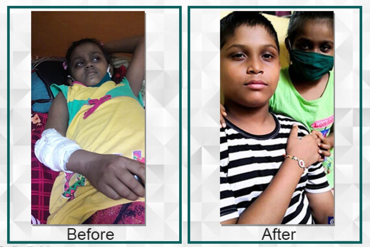 With the Help of Filaantro, Sia Samantha is free from Fanconi Anemia