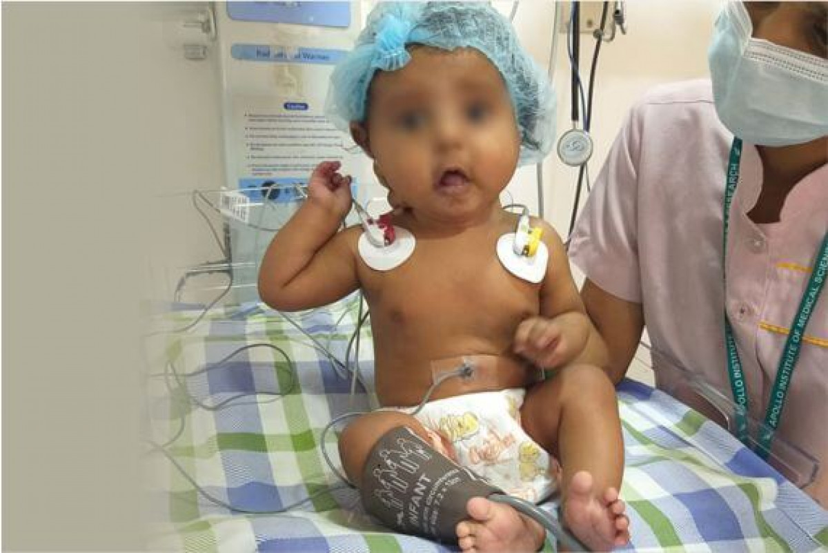 3-Months-Old Vennela Seeks Your Support for Heart Surgery. Please Help