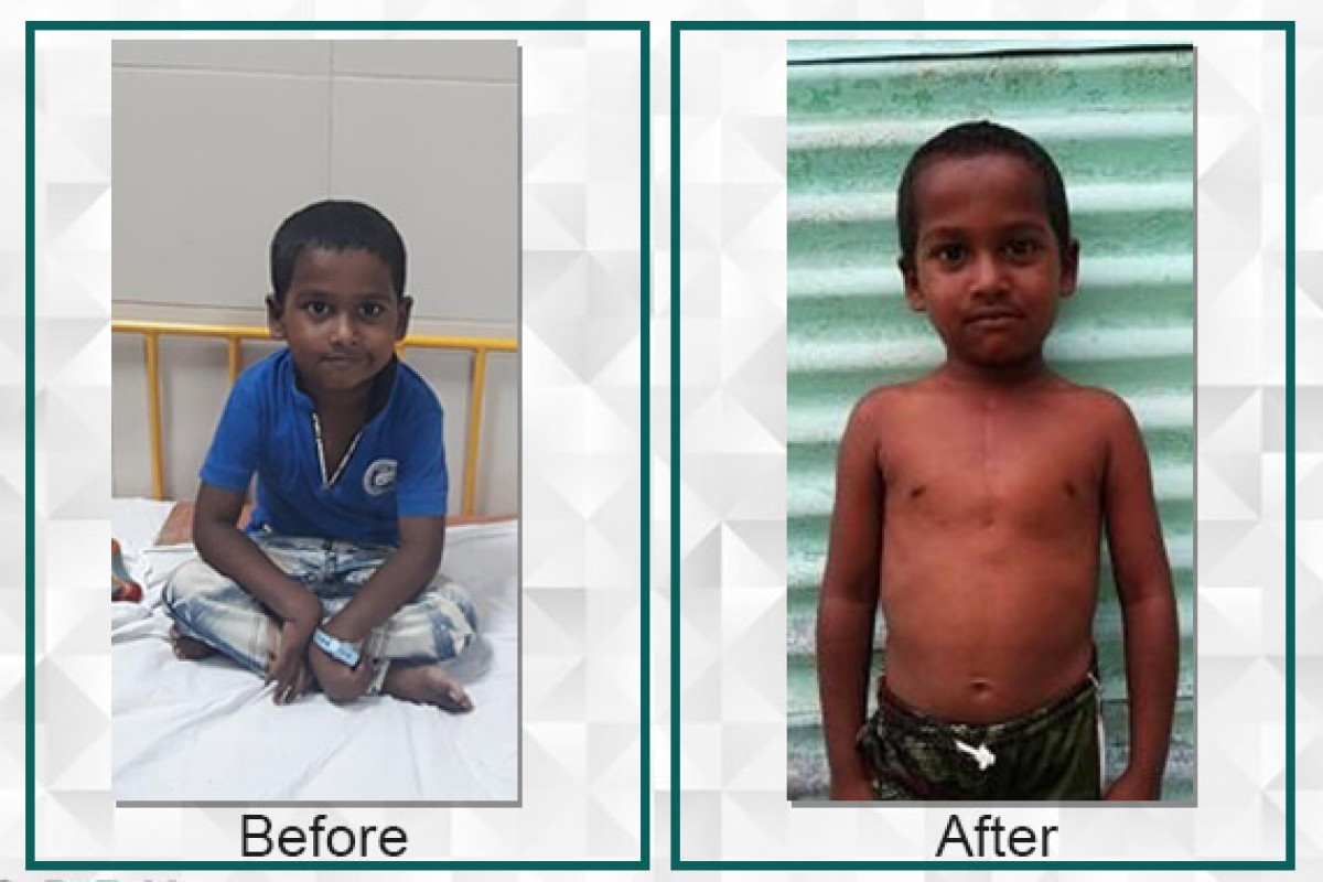 Sufiyan, born with heart disease was able to undergo surgery with the help of Filaantro