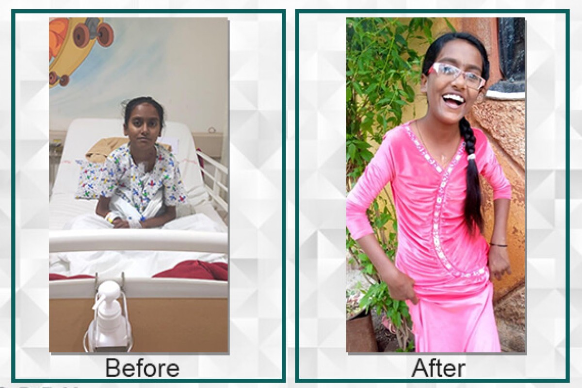 Suvarna raised Rs.4,25,000/- for her heart treatment with the help of Filaantro (Suman completed the treatment of her heart and now is well an fine)