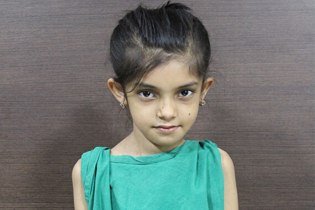 Sidra Fatima, a 10 year old girl is suffering from congenital Syndromic Scoliosis. She will undergo a growth rod insertion. | Please support her treat