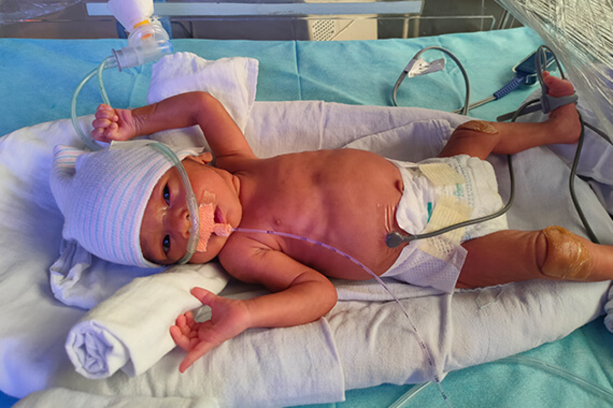 A 25-day old premature baby boy requires 1 month of NICU stay to live.