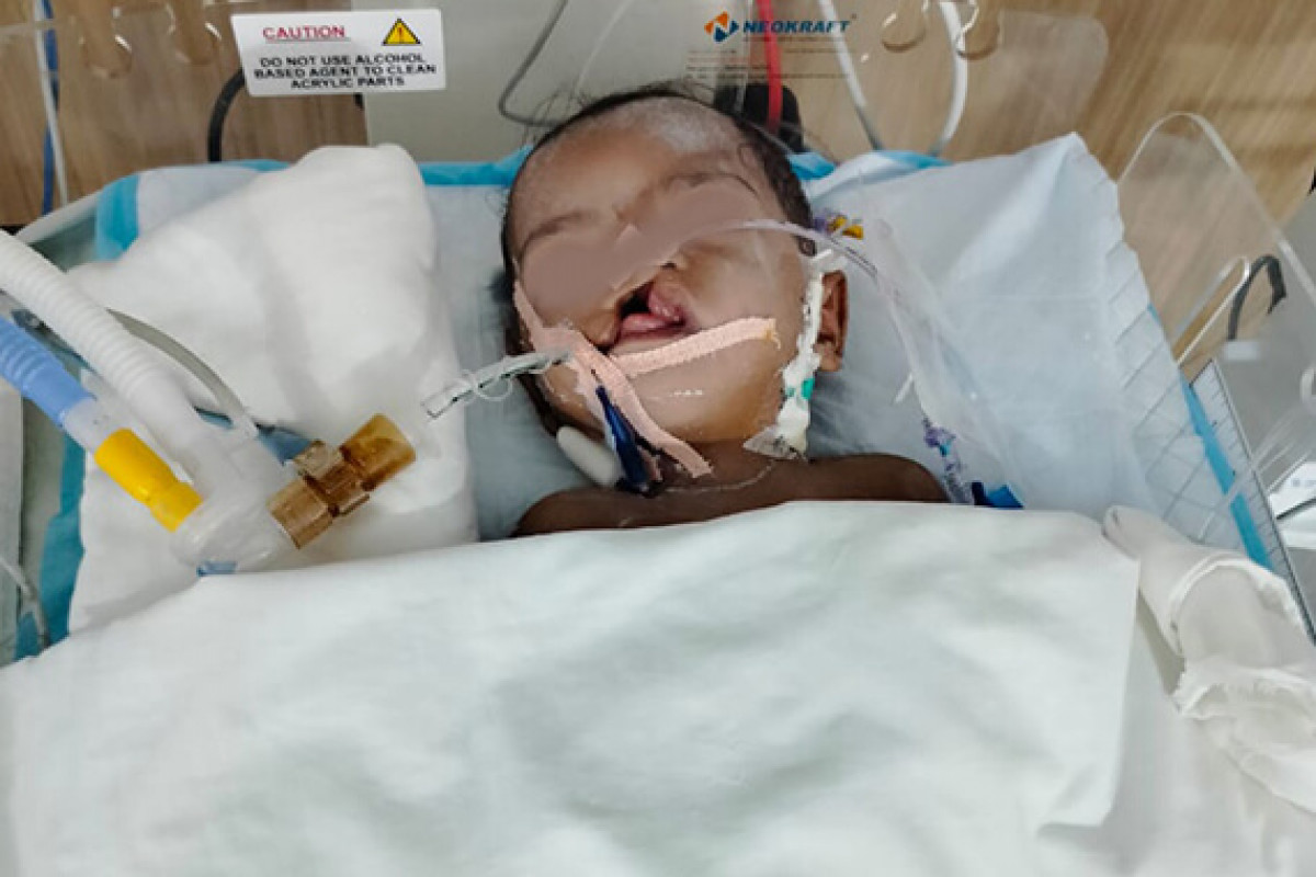 6 months old and already battling for life, Please Save Chetan