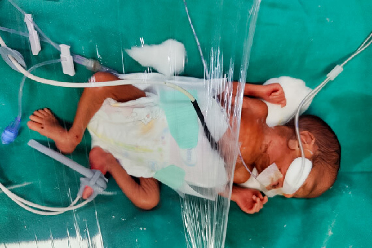 25-Days Old Baby Boy is Suffering Preterm Symptoms, Help Him Survive!