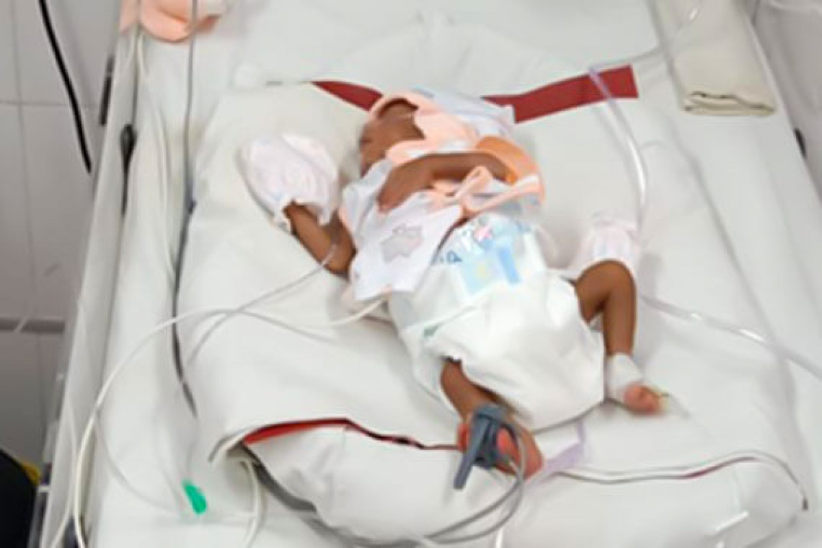 Deepika’s Baby Boy struggles to breathe, Please help this little child