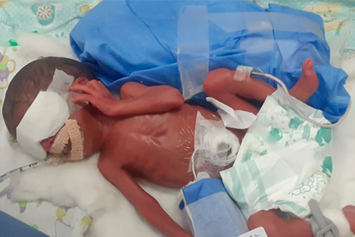 Help a father in distress to save his 3-days-old preterm baby