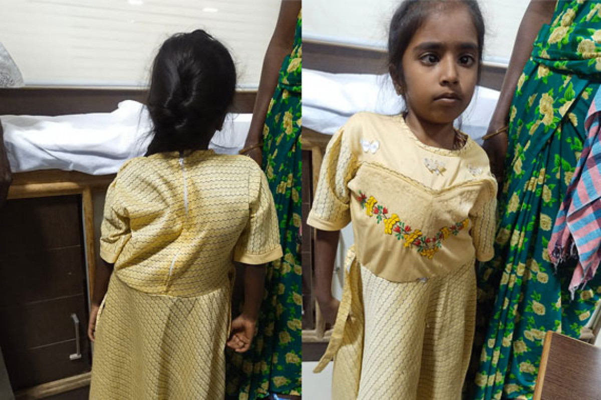 A spinal deformity has caged Shivadarshini's childhood. Support her treatment.