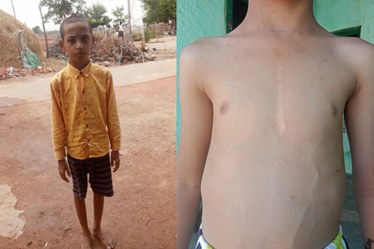End a 10-year-old boy's suffering by helping him to undergo heart surgery