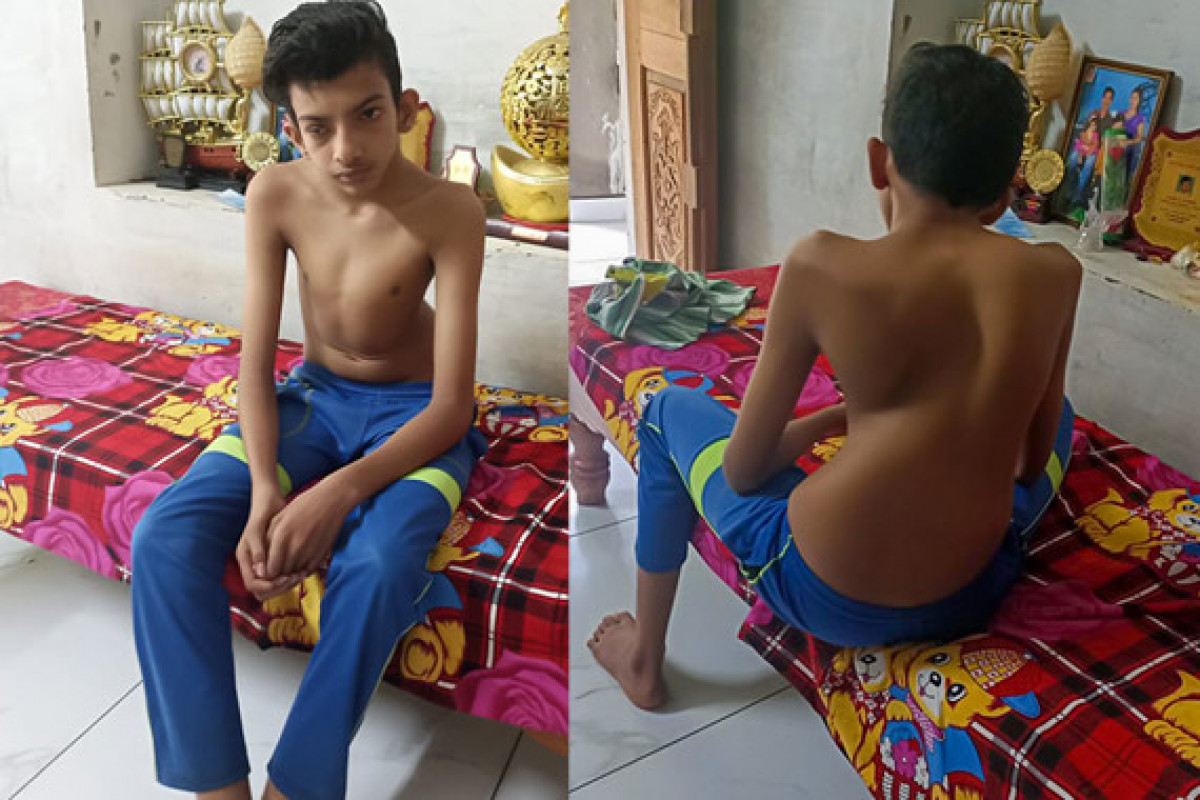 Crespo lost his childhood to a Spinal Deformity. Help him!