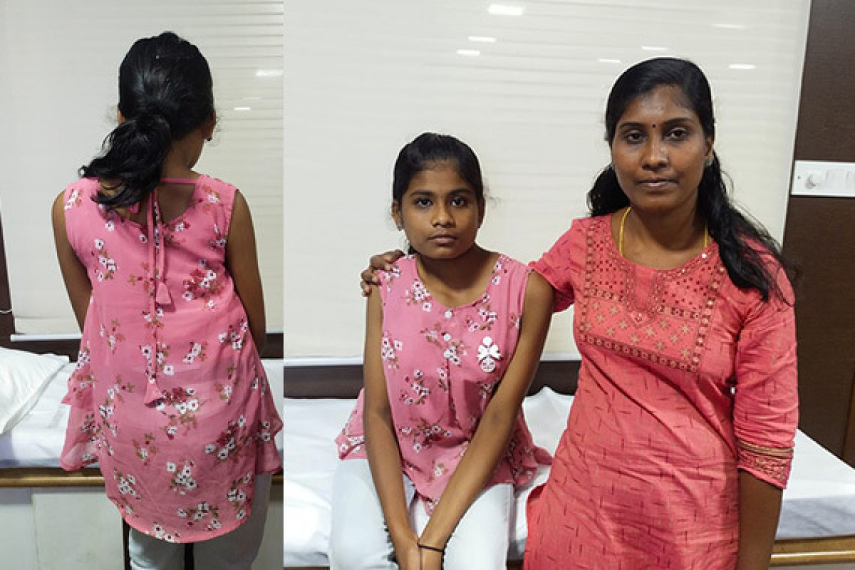 Save Little Akshaya From Congenital Kyphoscoliosis