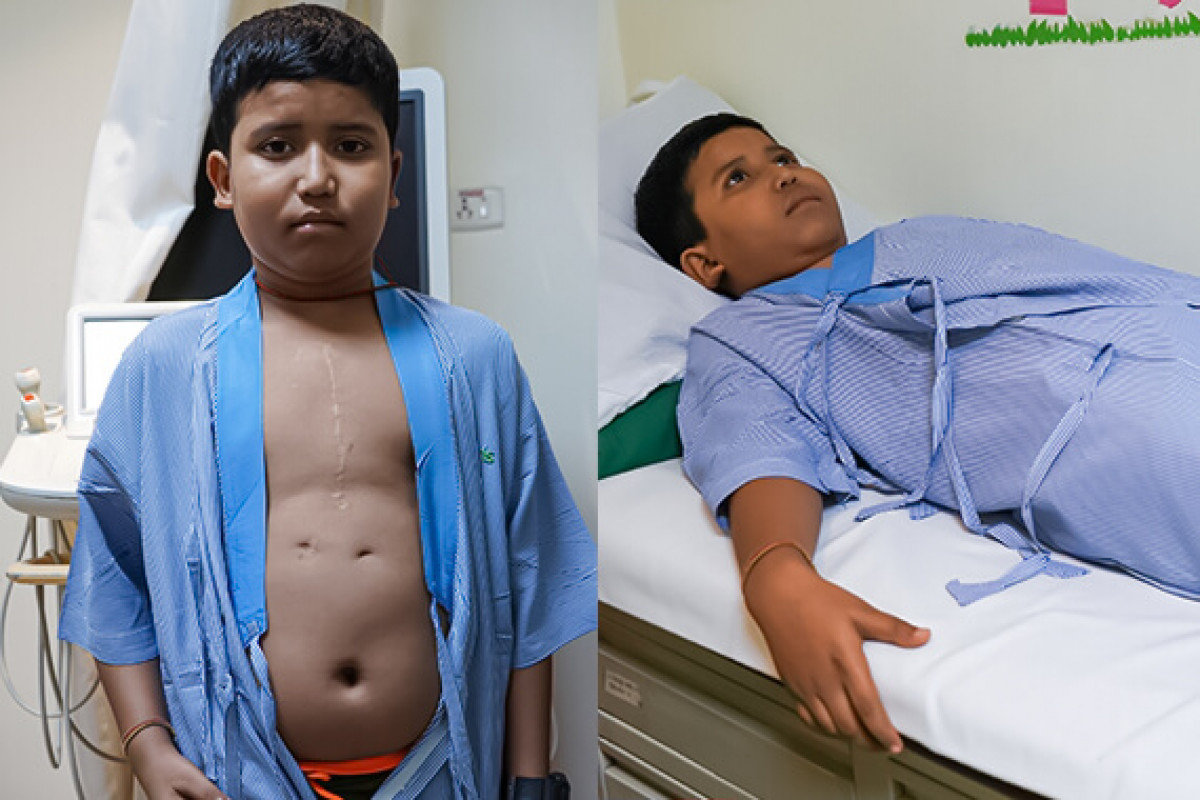 Help 9-year-old Lochan Survive a Complex Heart Defect!