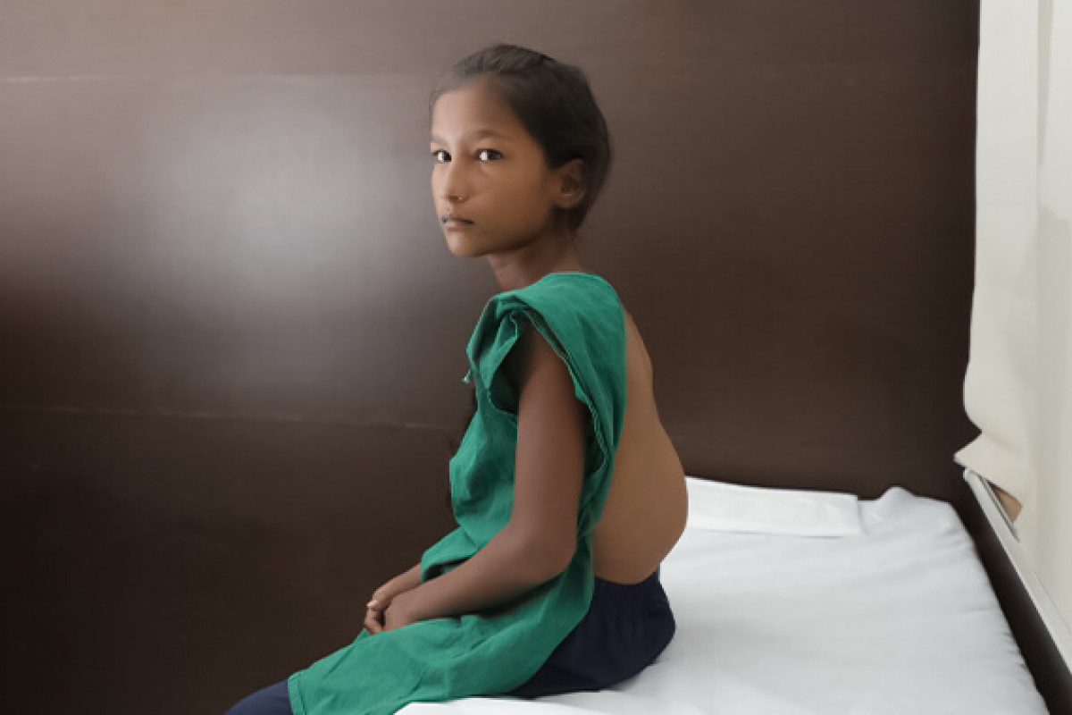 13-year-old Mounika has had a spinal defect since birth. She needs your support