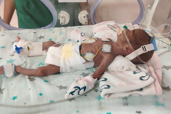 Please support Bhagyashree’s 6-days-old baby boy, fighting to take his next breath