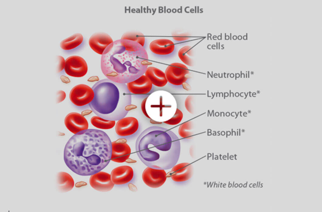 Unveiling the Mystery: Understanding Blood Cancer and Its Types