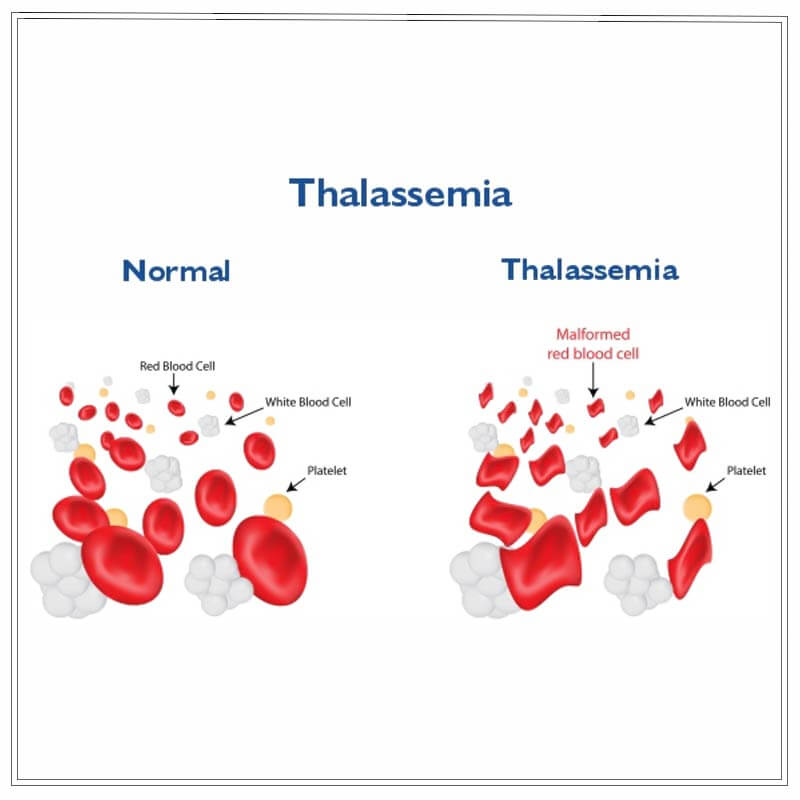 thalassemia awareness