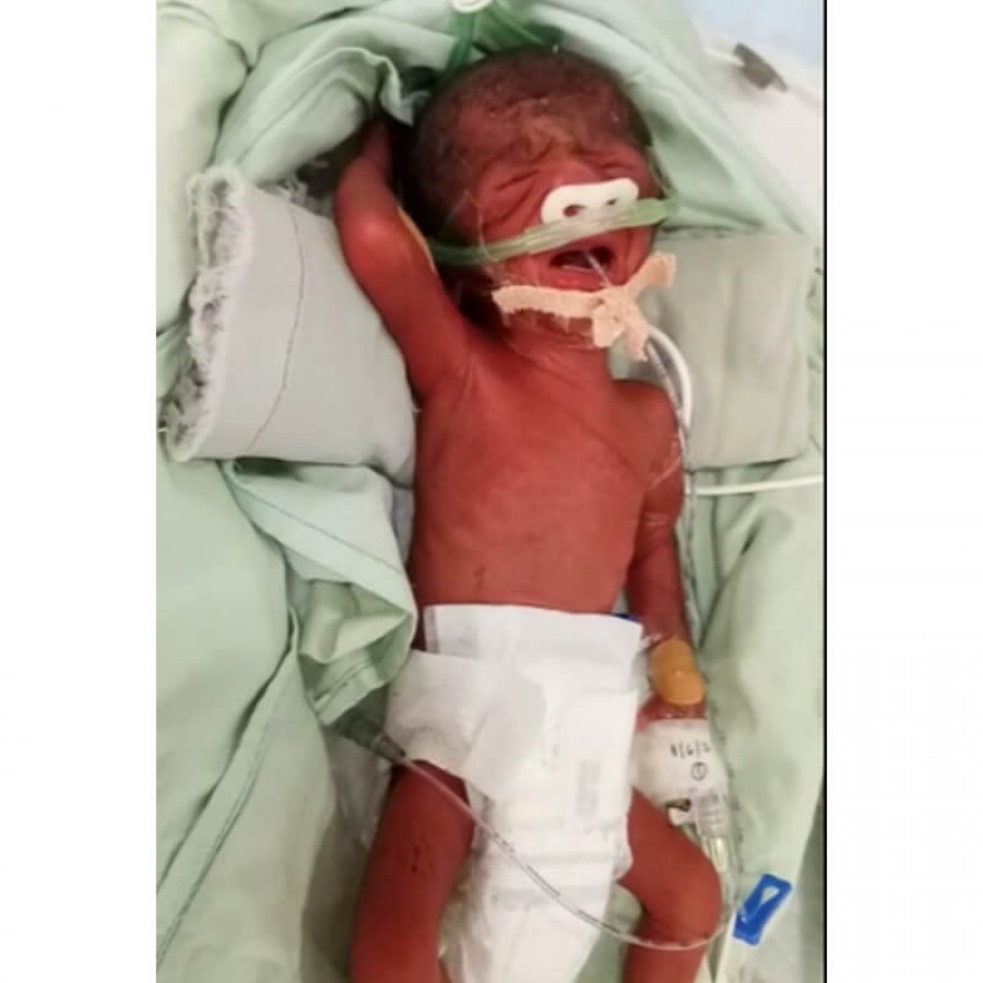 5 month 2024 premature baby